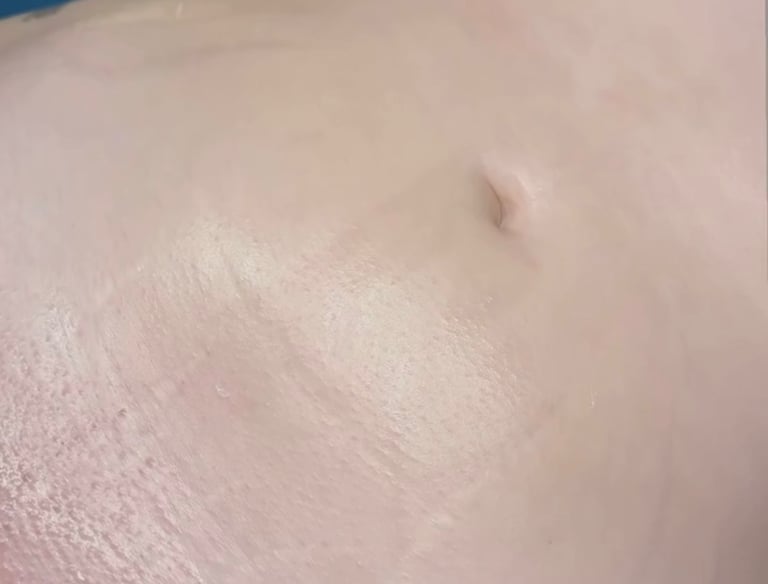 Brazilian or bikini line