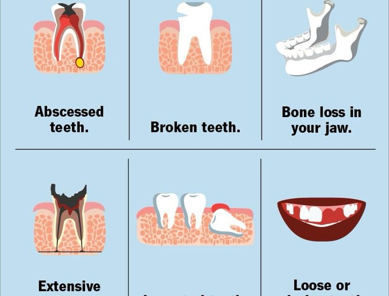 bone loss, broken teeth treatment