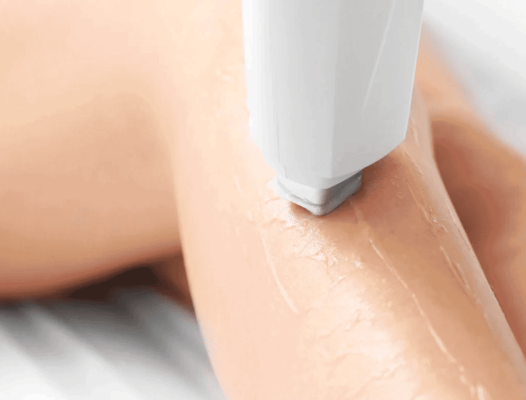 epilazione centro estetico caggiano