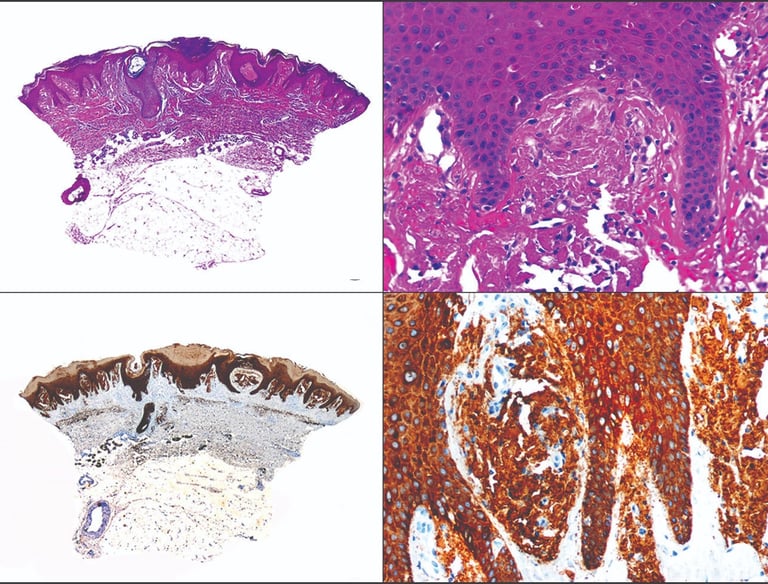 inmunoistoquimia