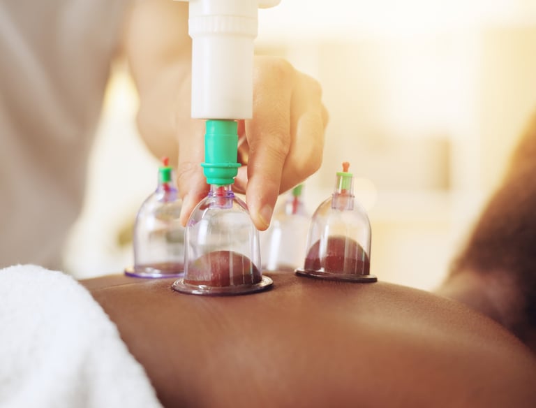 a person is getting cupping as part of a remedial massage