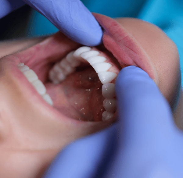 فحص ومعاينة الأسنان - عيادة طب الاسنان دكتور وسام علي 