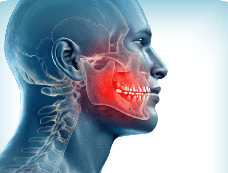 Cráneo humano con la mandíbula y los dientes resaltados en rojo, indicando dolor mandibular