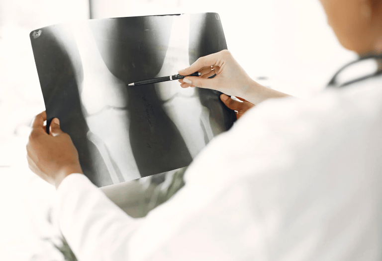 Doctor looking at x-rays