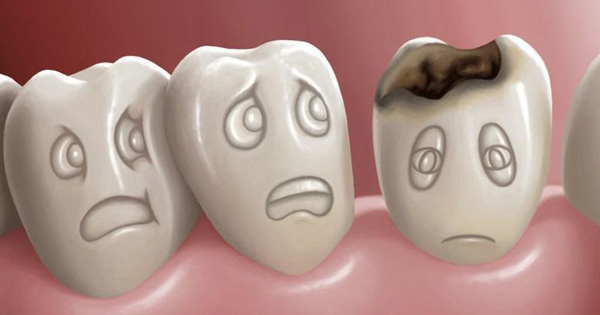Carie, conservativa, endodonzia