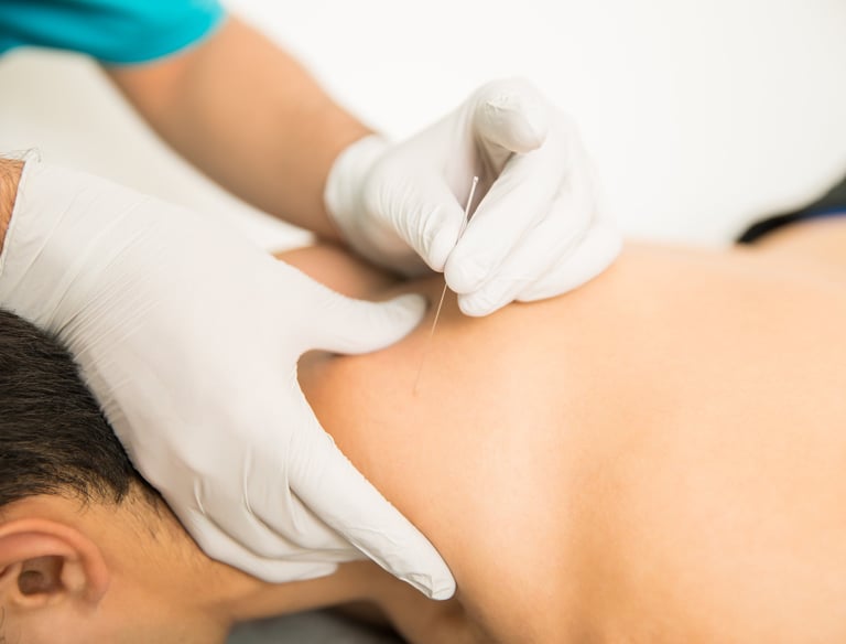 dry needling