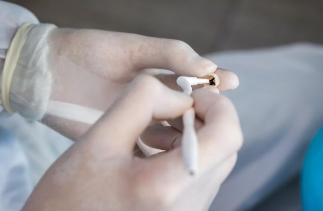 dental crown greenville SC