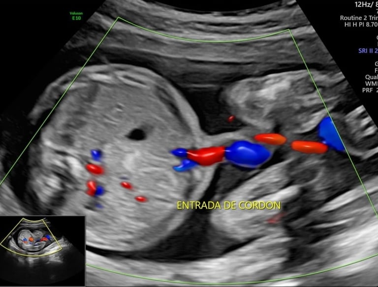 Ultrasonido tercer trimestre, flujometría, ultrasonido doppler