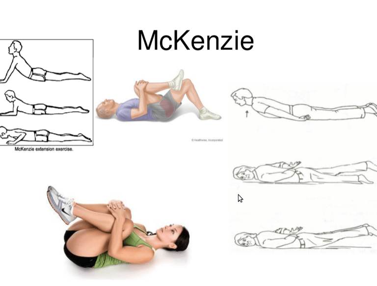 Exercícios McKenzie