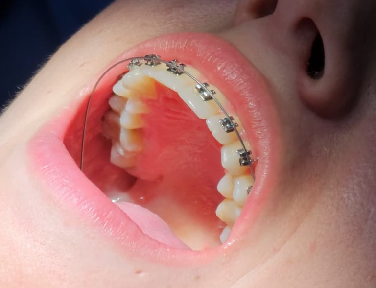 brackets metalicos badajoz