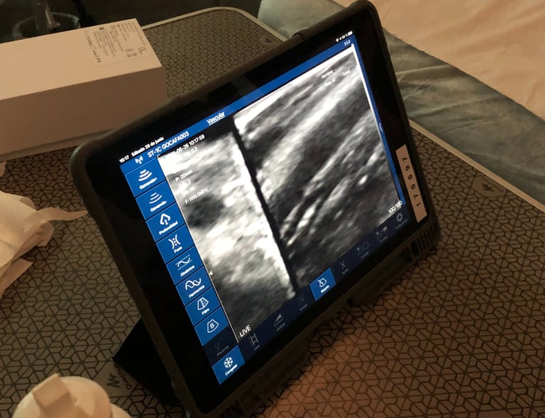 Taller para aprender el manejo de una sonda lineal biplano