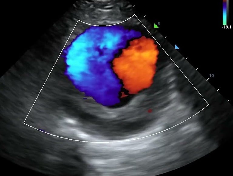 vascular ultrasound imaging perth corewave best vein artery treatment symptom scan doppler bulk bill doctor recommend near me