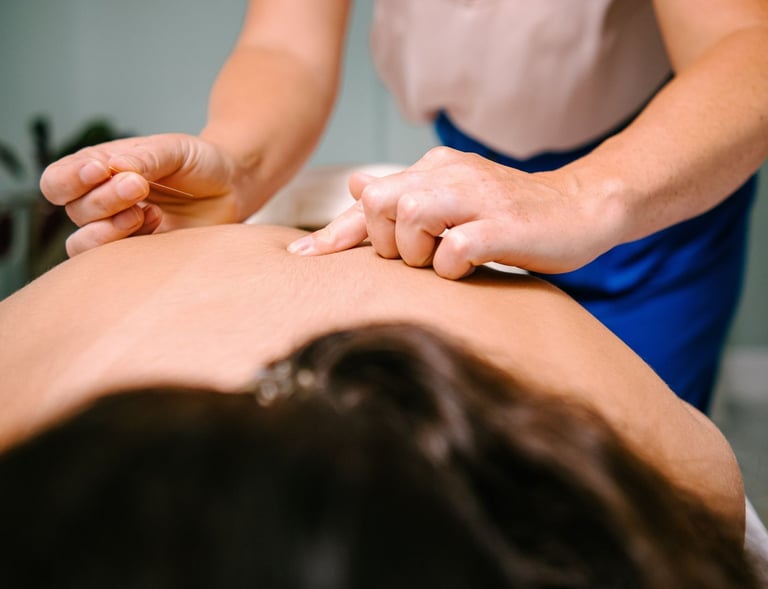 Professional acupuncturist inserting a sterile needle into a patient's back for dry needling therapy.