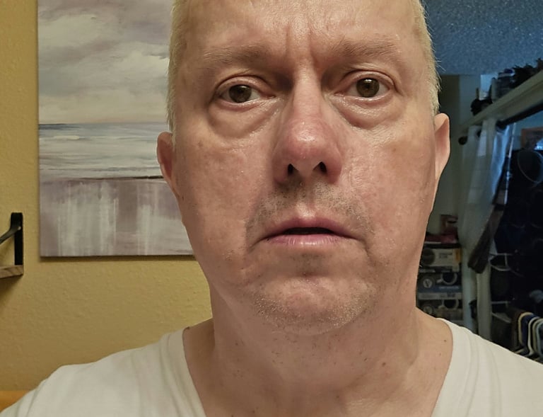 facial psoriasis healed