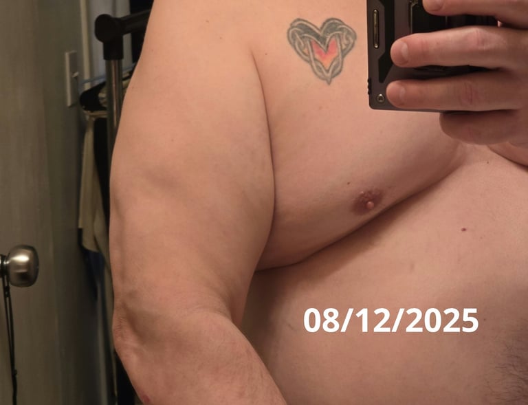 arm psoriasis healed