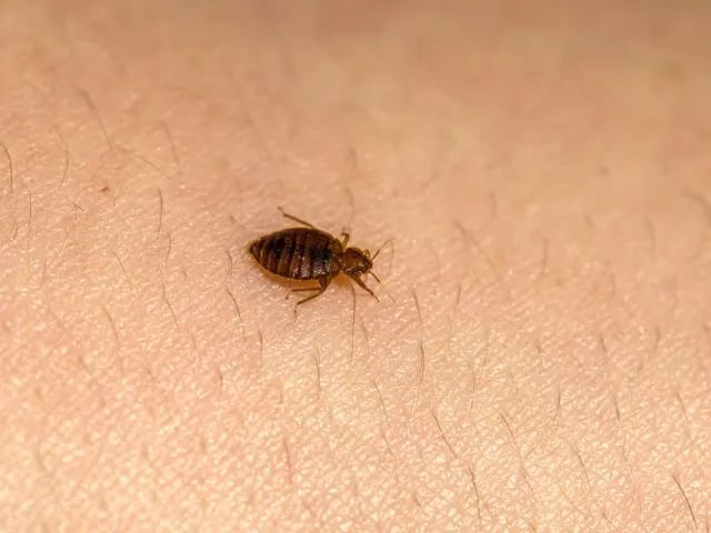 a bed bug crawling on someone's skin