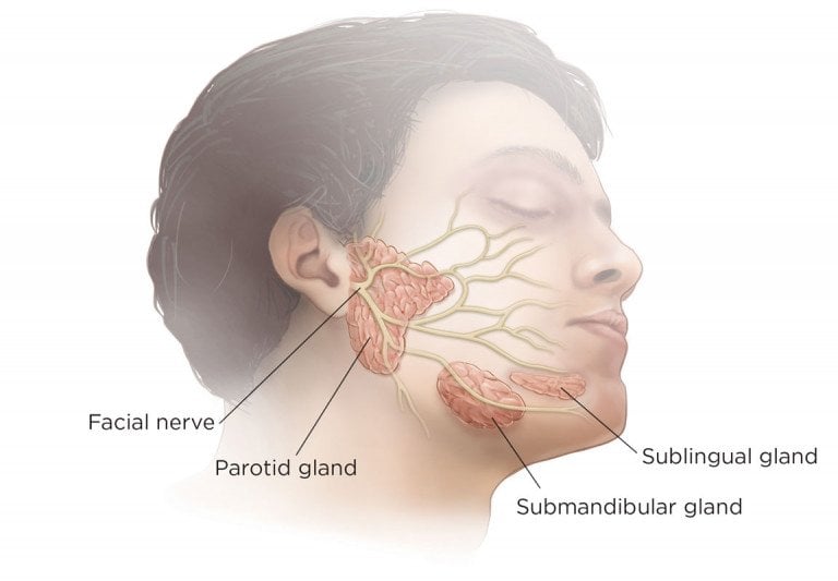 παρωτίδα λίθος σιελογόνοι αδένες Καβάλα