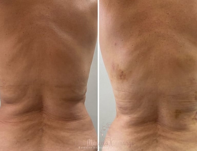 a man with a very large back and a very small back