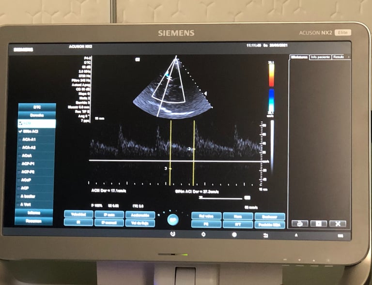 Taller para localizar la arteria cerebral media
