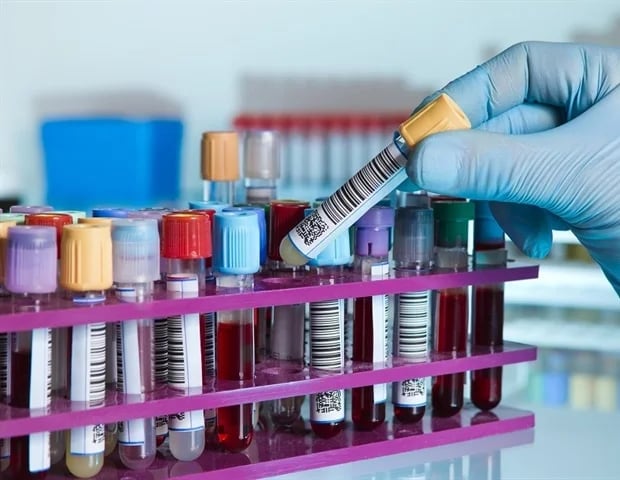 Autoimmune disease state samples