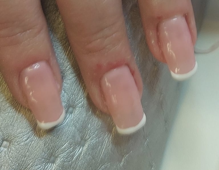 Behandling med tippar & Fransk