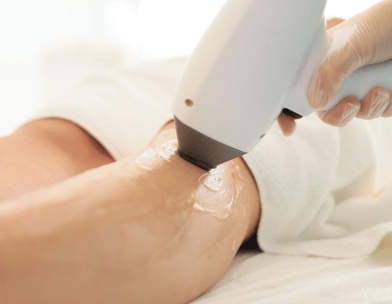 a person is getting a laser epilation 