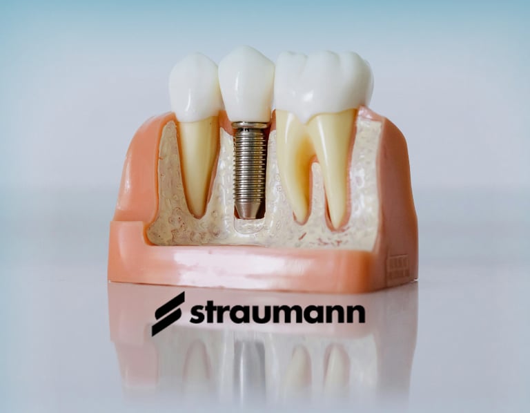 Modelo de mandíbula mostrando un implante dental Straumann junto a dientes naturales