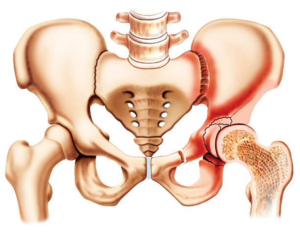 back pain, physiotherapy egmore