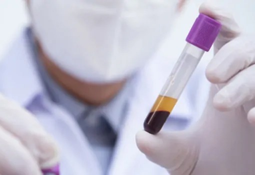 a doctor with a mask holding a test tube of blood with gloved hands