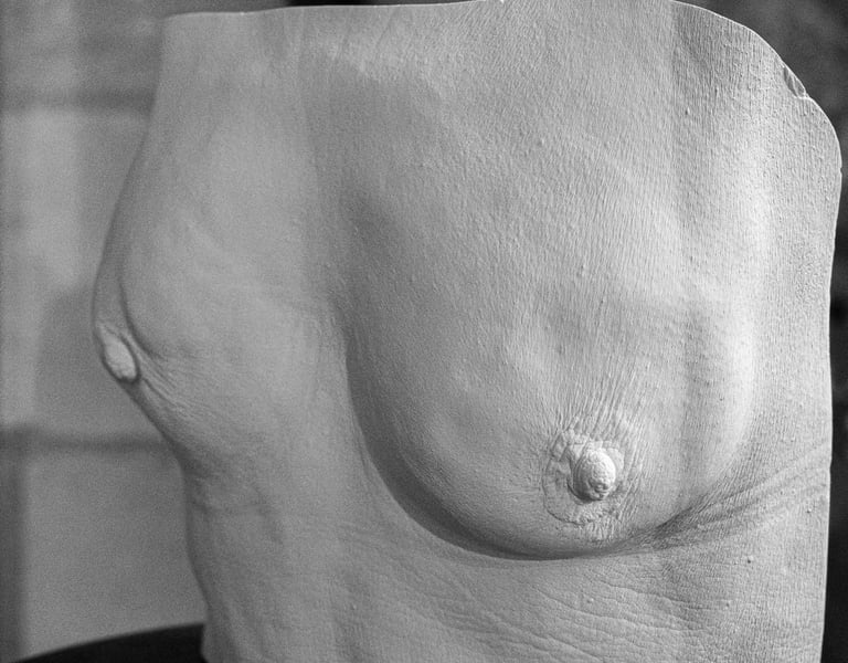Moulage femme atteinte du cancer du sein - Moulage intime Bordeaux