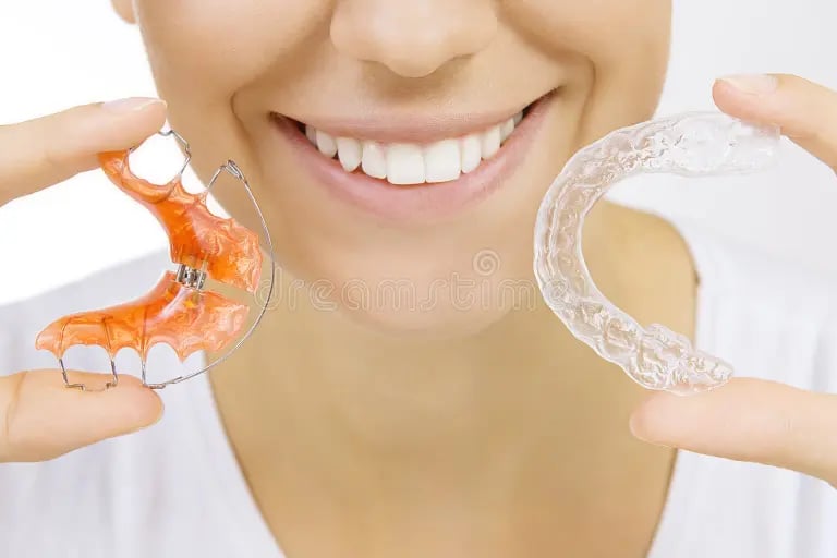 Retainer gigi di Sidharta Dental Studio Malang untuk menjaga hasil perawatan ortodonti