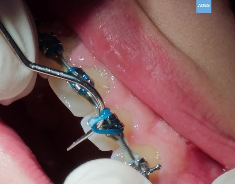 revision ortodoncia clinica dental ades