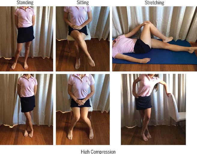 Grimaldi gluteal tendipathy advice