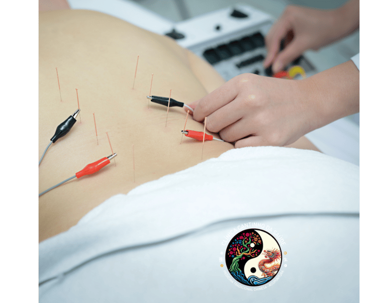 a woman is shown with needles and needles in her hand