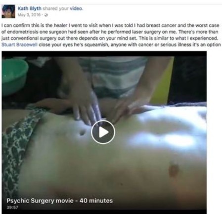 Psychic Surgery on Patrick
