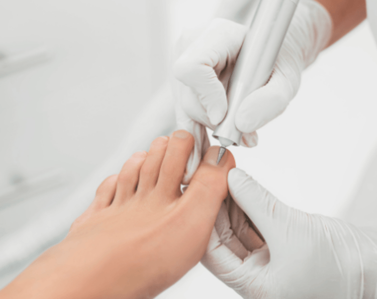 Professionele voetverzorging met een medisch instrument uitgevoerd door een pedicure.