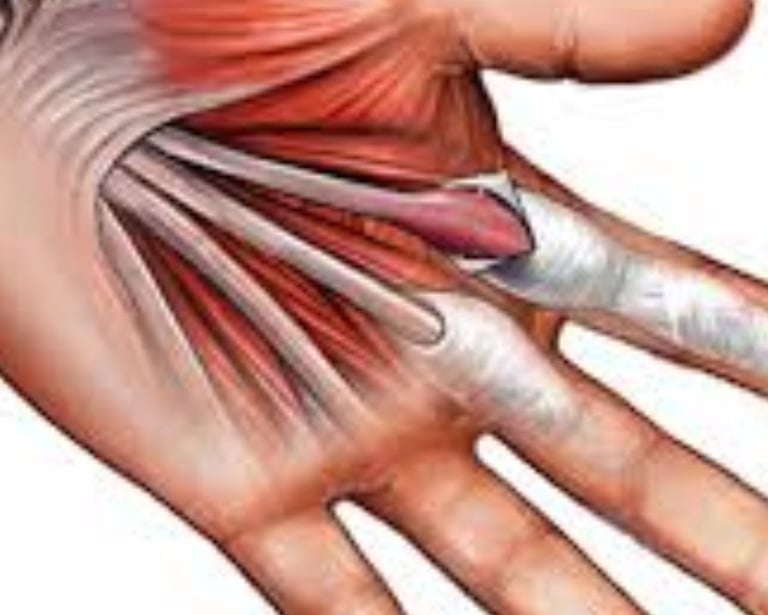 🤲 Trigger Finger & the Role of Voluntary Fasting A Natural Healing Approach