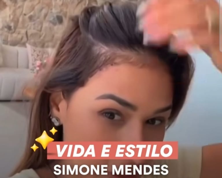 cirurgia cantora simone mendes testa