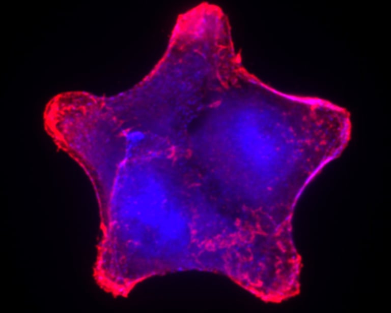 Metastatic Cancer Cell