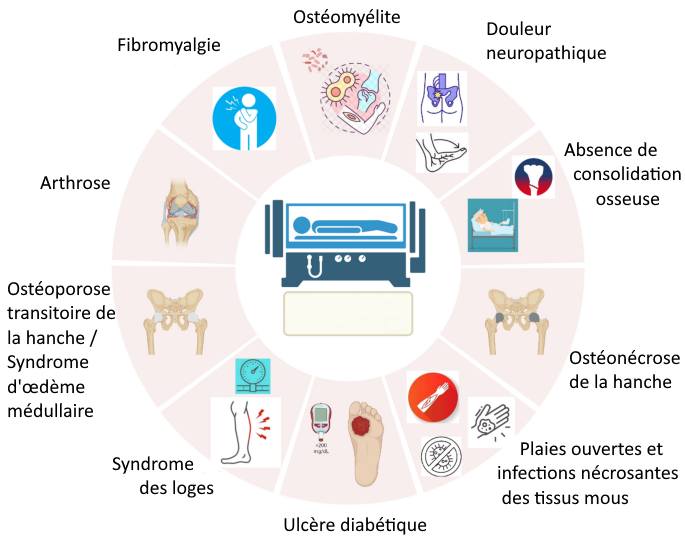 Image d'un dispositif médical hyperbare au centre, entouré des conditions médicales traitées