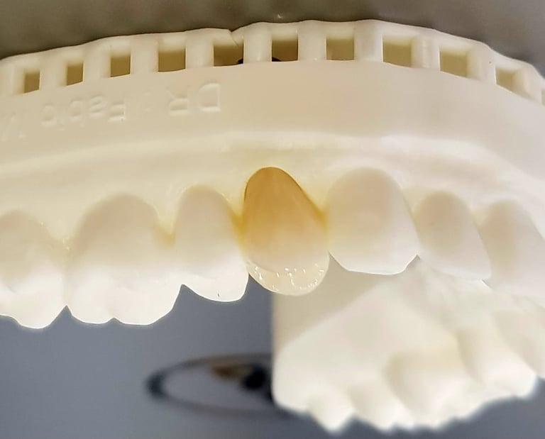 Moldura de dentes ilustrando implantes dentários realizados por dentista na Lapa PR.