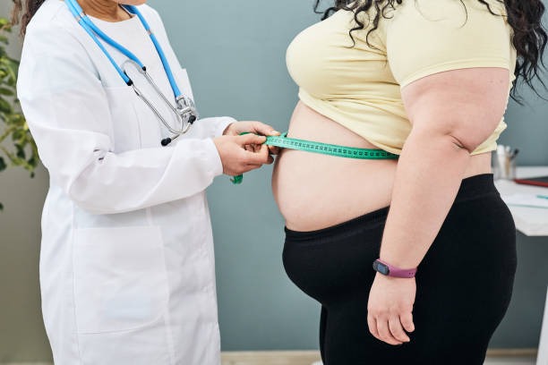 medmedecin mesure tour de taille femme en surpoids