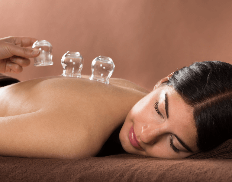 Professionele cupping sessie bij Medisch Pedicure Grote Berg in Callantsoog.