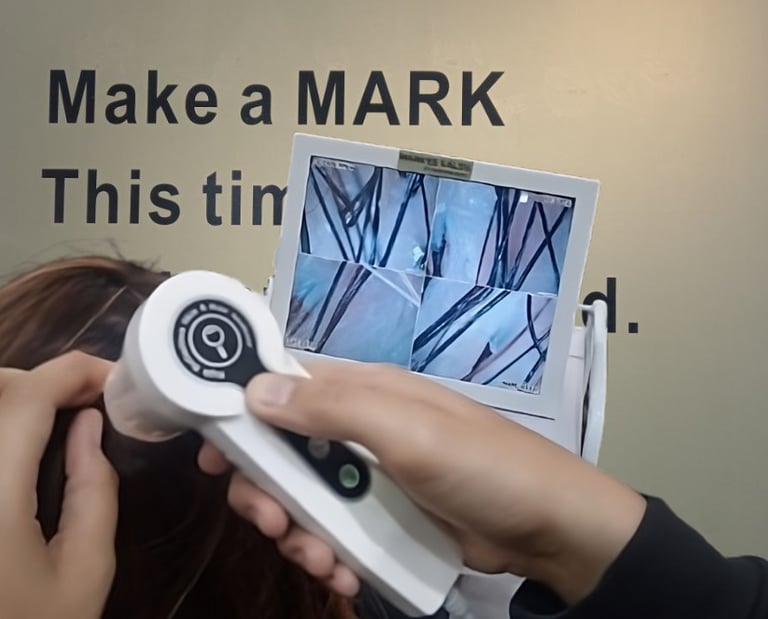 Hair Scalp Analysis