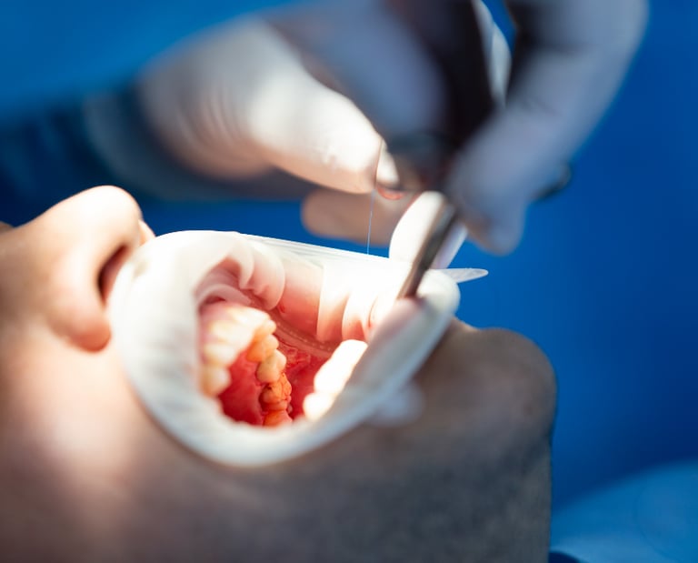 Endodonzia-Gambara-dentista-vivaldini