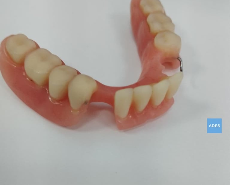 prótesis dental