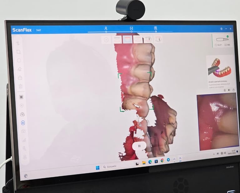 escáner intraoral 3D