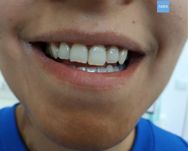 clinica dental ades ortodoncia infantil