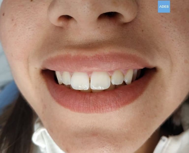 Ortodoncia infantil clinica dental ades