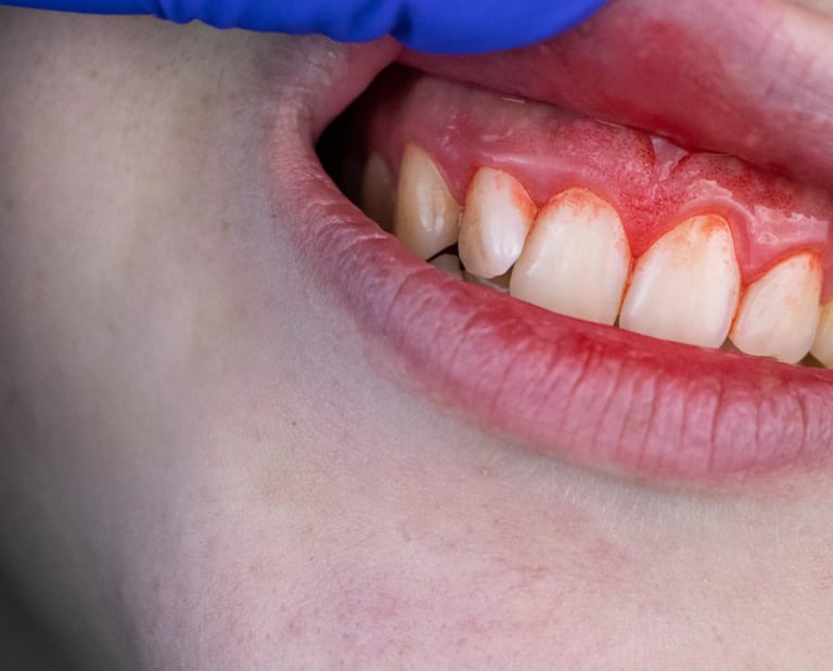 Periodoncia en Sevilla